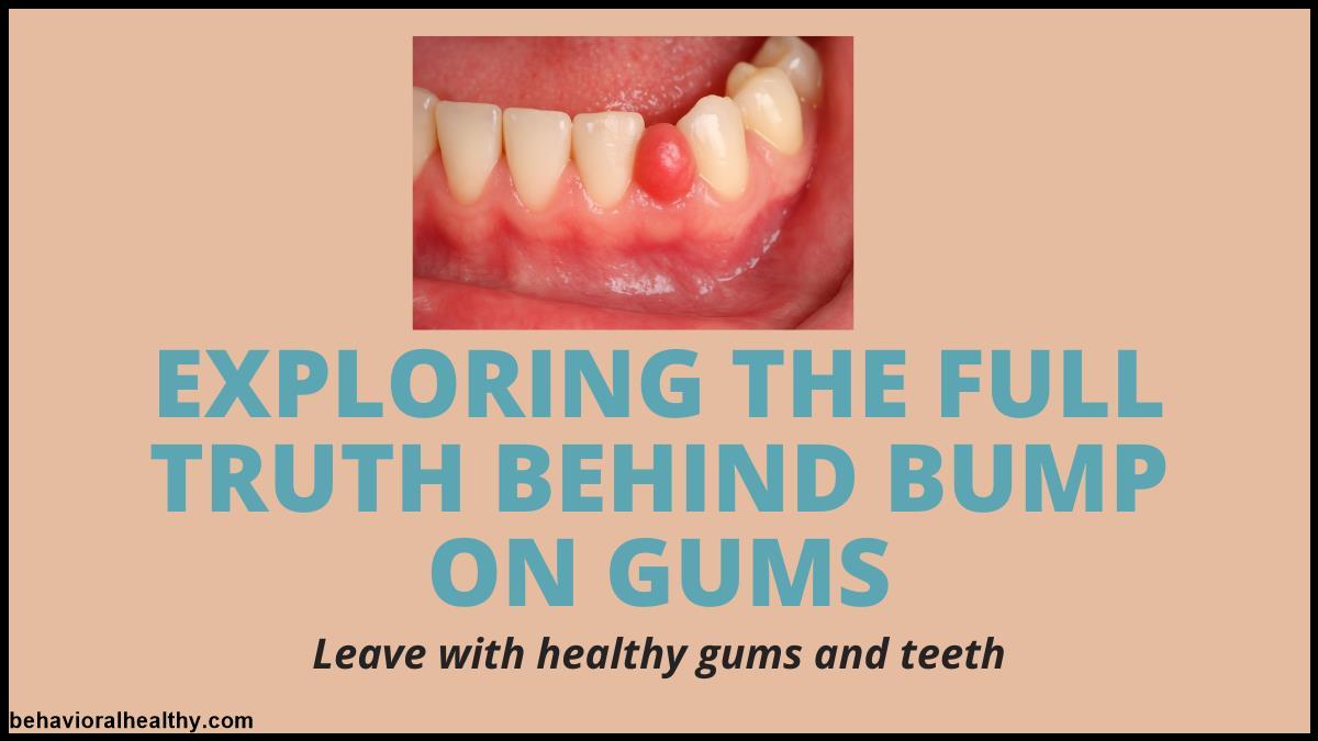 Exploring The Full Truth Behind Bump on Gums.jpg
